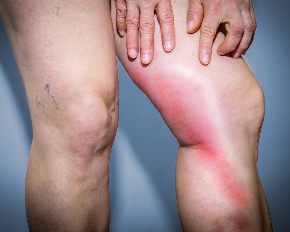 Is It Normal To Feel Your Veins Move at Sally Moore blog