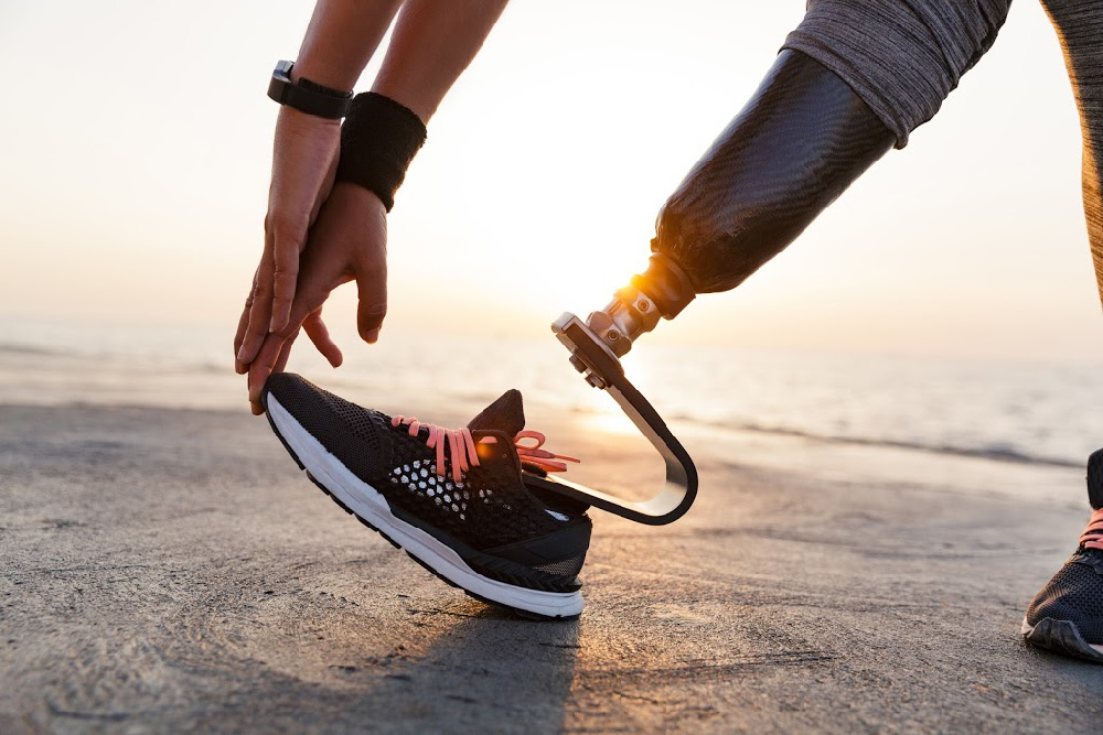 Your Guide to Getting Artificial Limbs HOPE KC