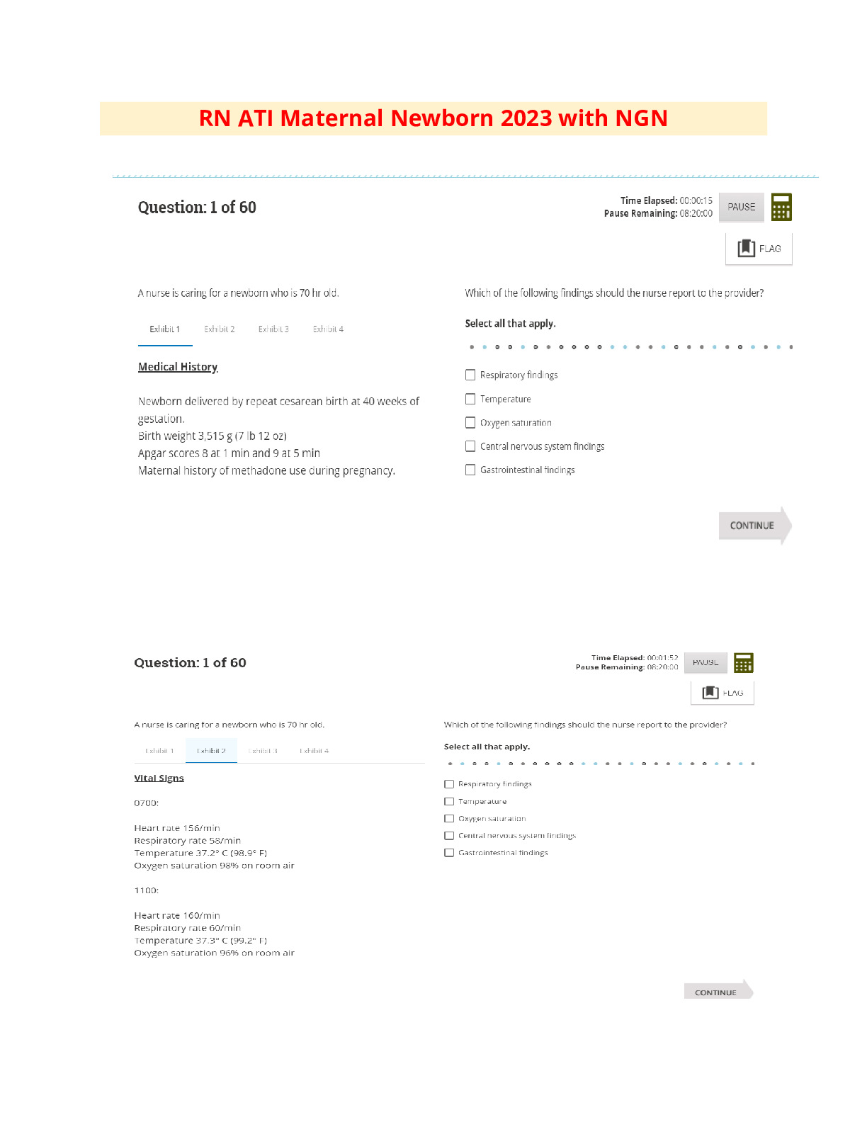 ATI RN MATERNAL PROCTORED ASSESSMENT 2023/2024(20 versions)/RN ATI