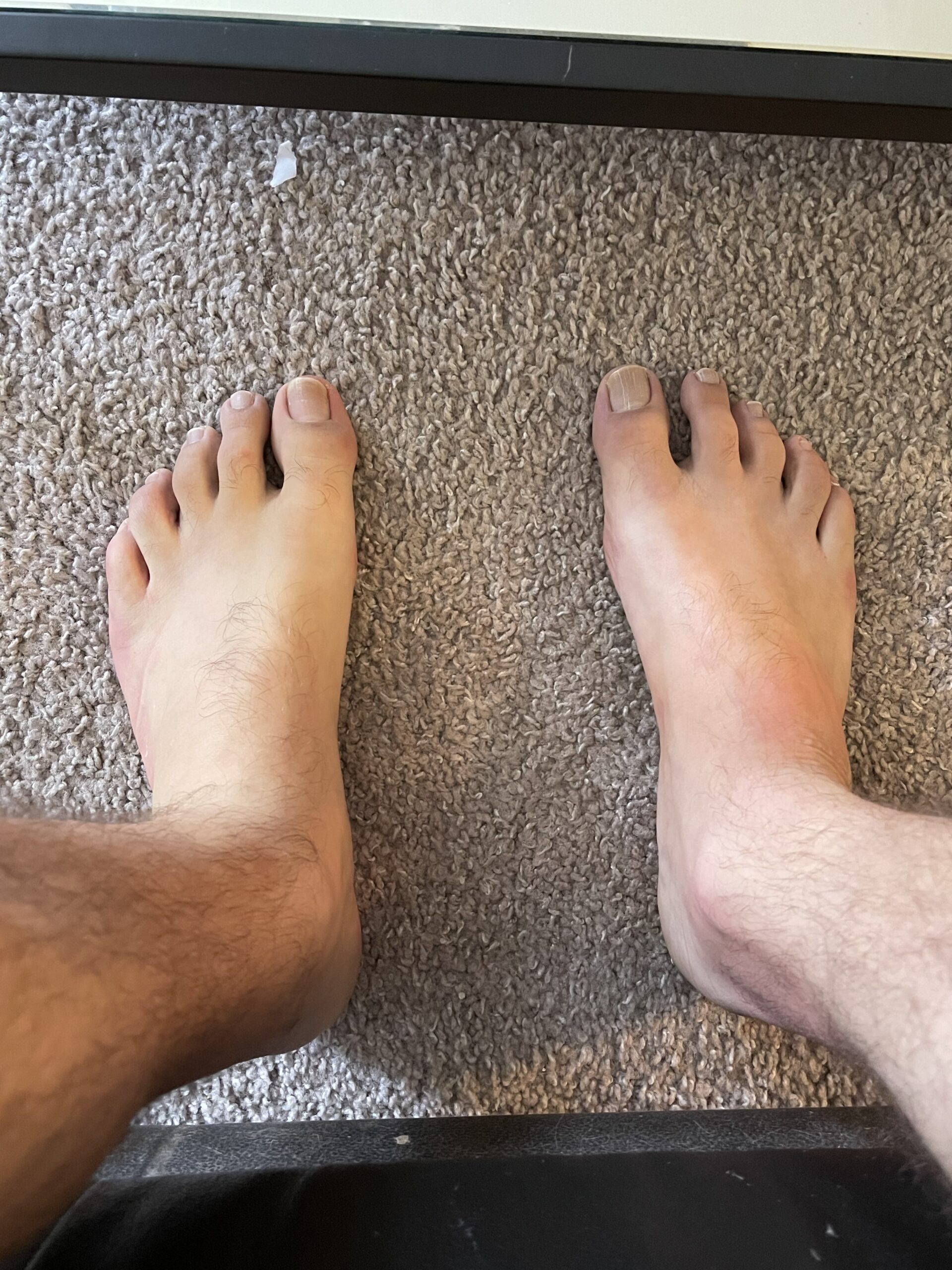 Hairy feet ;) Fun With Feet