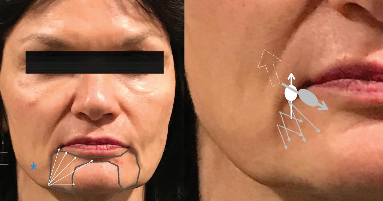 The step by step approach to lines Issuu