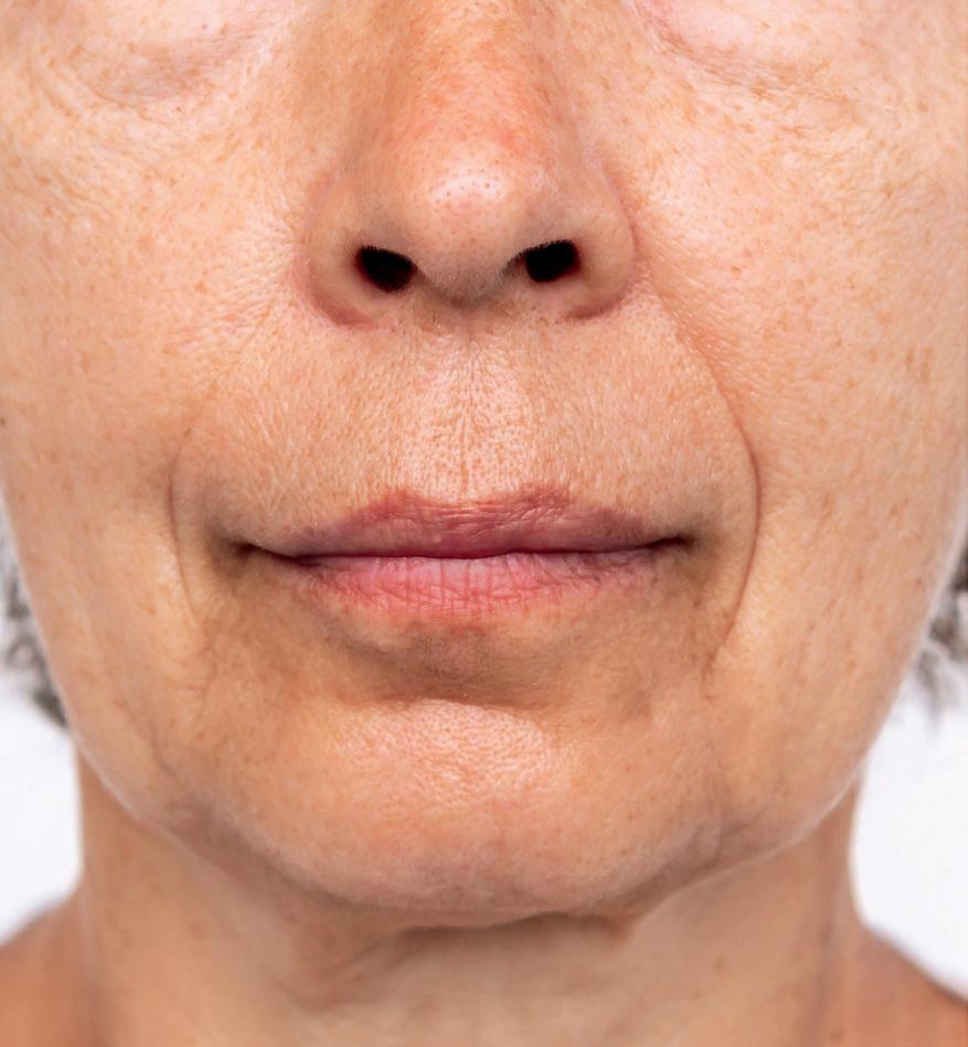 The step by step approach to lines Issuu