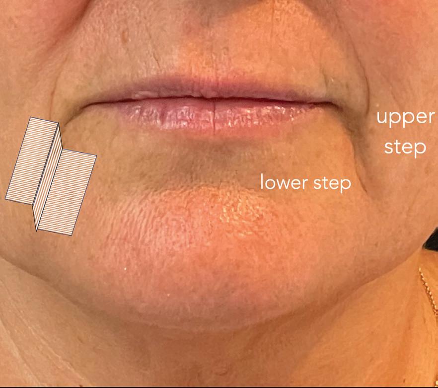 The step by step approach to lines Issuu