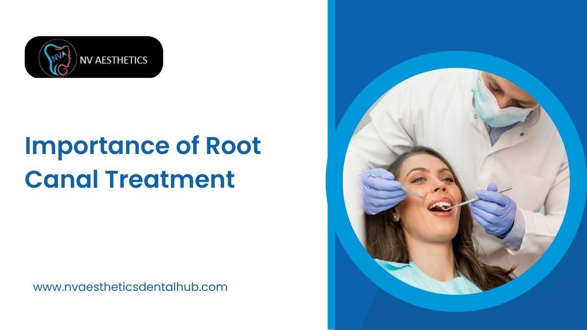 Importance of Root Canal Treatment by NV Aesthetics And Dental Hub Issuu