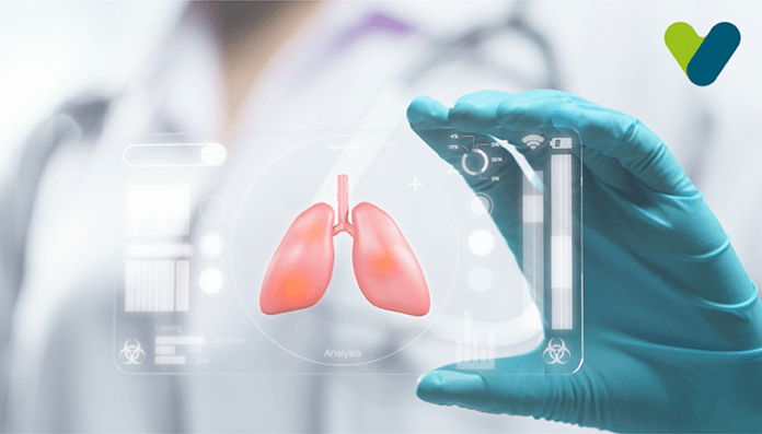 Bronchitis and Pneumonia – Various Differences Explained Bronchitis and Pneumonia – Various Differences Explained