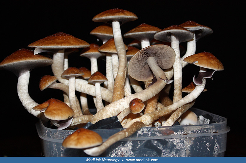 Hallucinogenic mushroom intoxication and poisoning MedLink Neurology