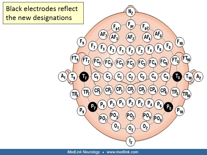 EEG in epilepsy MedLink Neurology