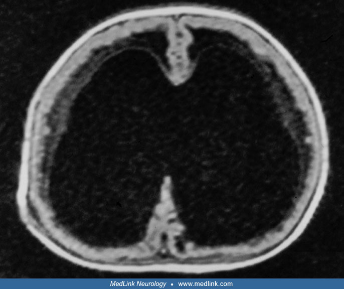 wwpb3e MedLink Neurology