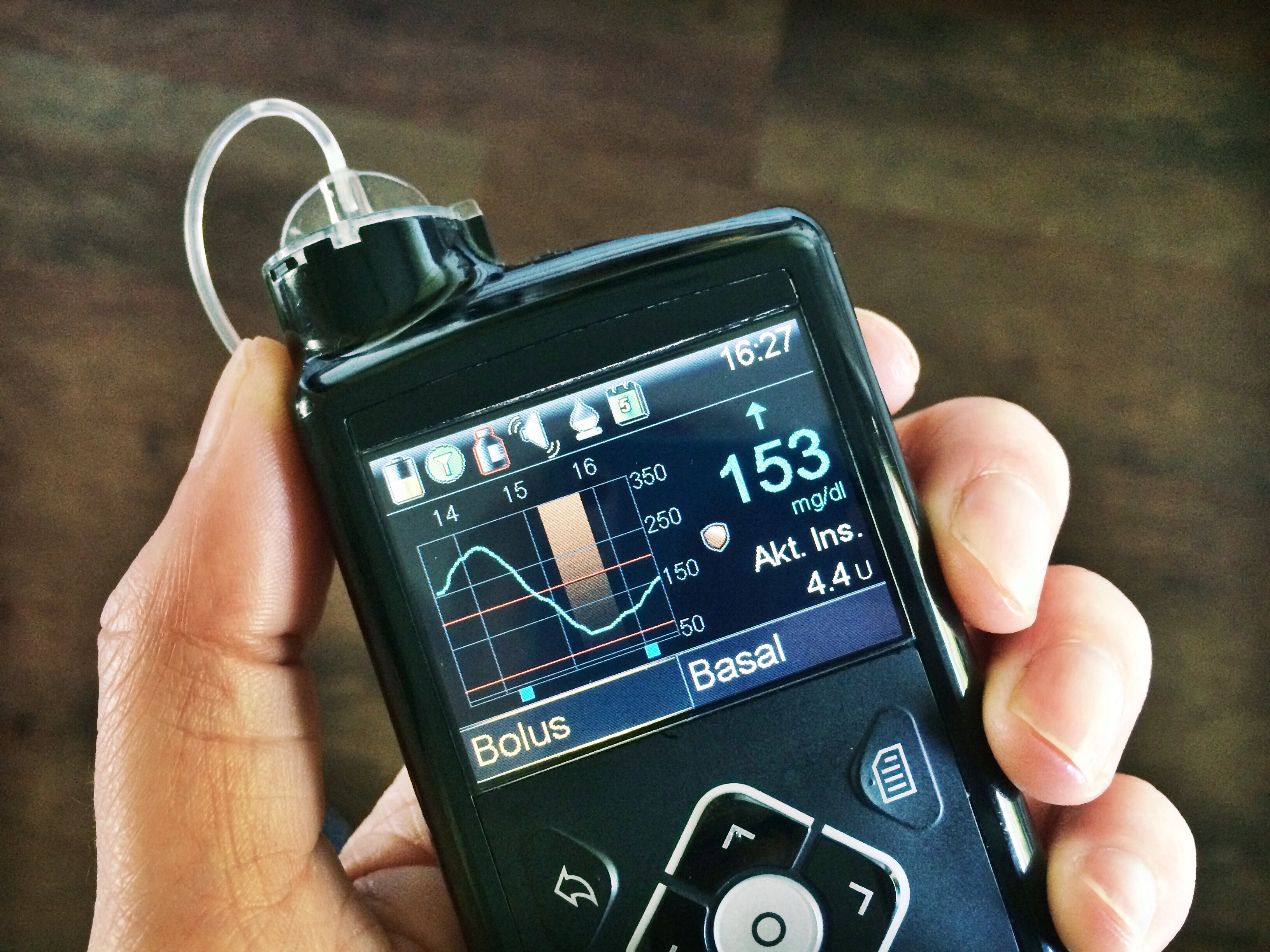 Mehr Durchblick mit CGM mySugr DiabetesHealthcare mit mySugr