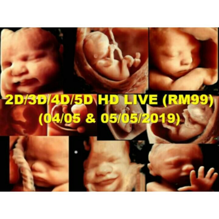 5D 6D SCAN SONOVISION What Is The Difference Between 2D 3D, 46 OFF