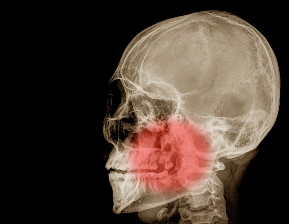 6 Obvious Signs of Gluten Intolerance That Everyone