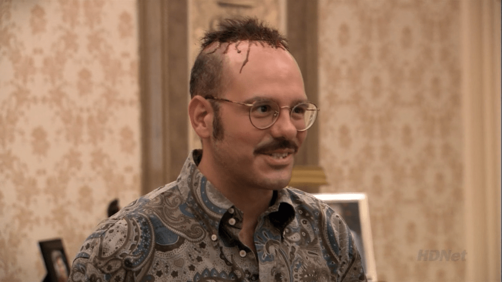 Rumored Merab... hair transplant? Sherdog Forums UFC, MMA