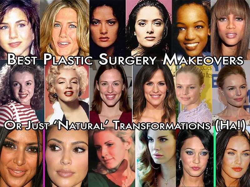 Want To Look Younger Without Surgery? Dr Youn Tells You How! Popdust