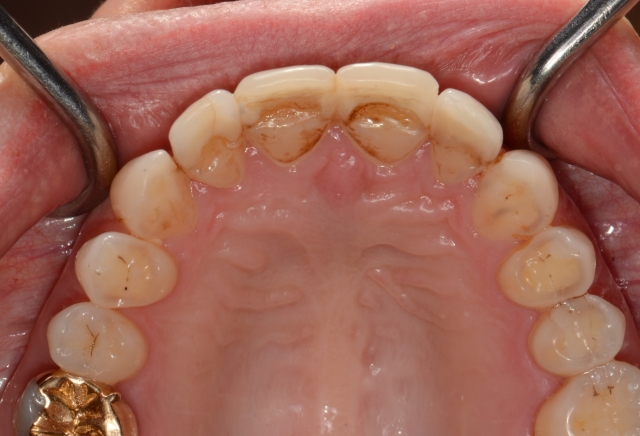 Technology Doesn’t Always Make for Better Dentistry Spear Education