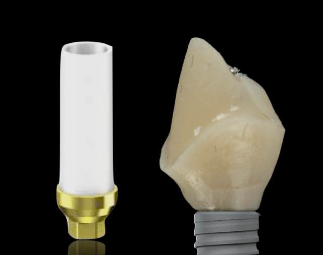 The Custom UCLAMetal Ceramic Abutment Spear Education