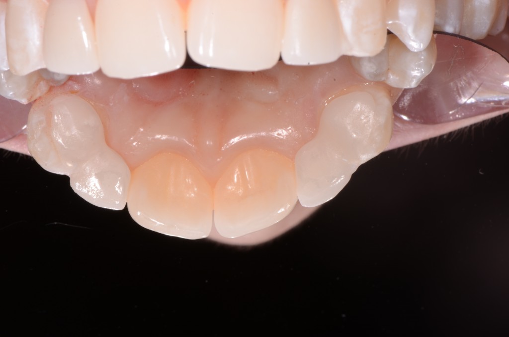 Teachable Moments in Dentistry Spear Education