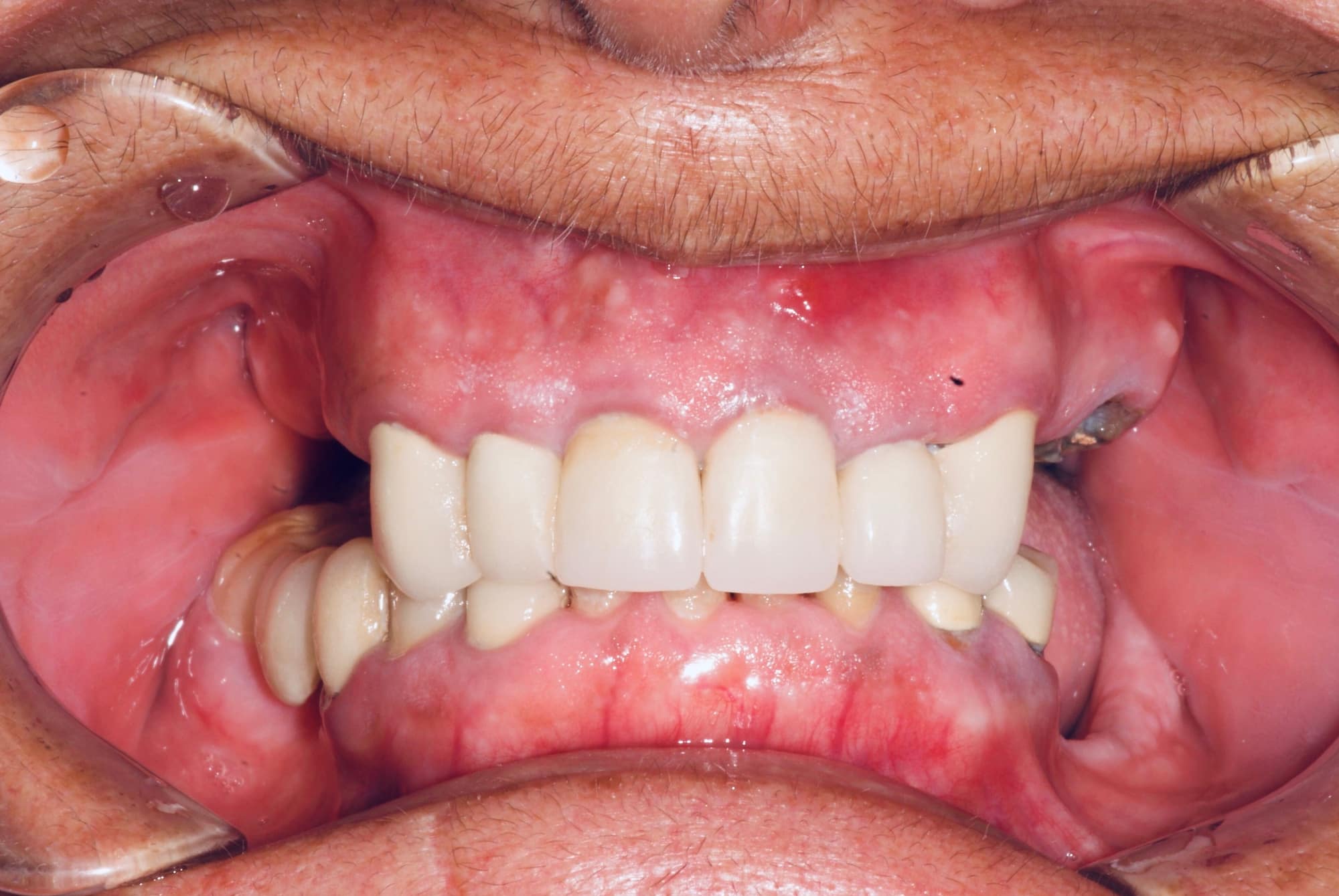 Photo Gallery Sherman Oaks Dental Group