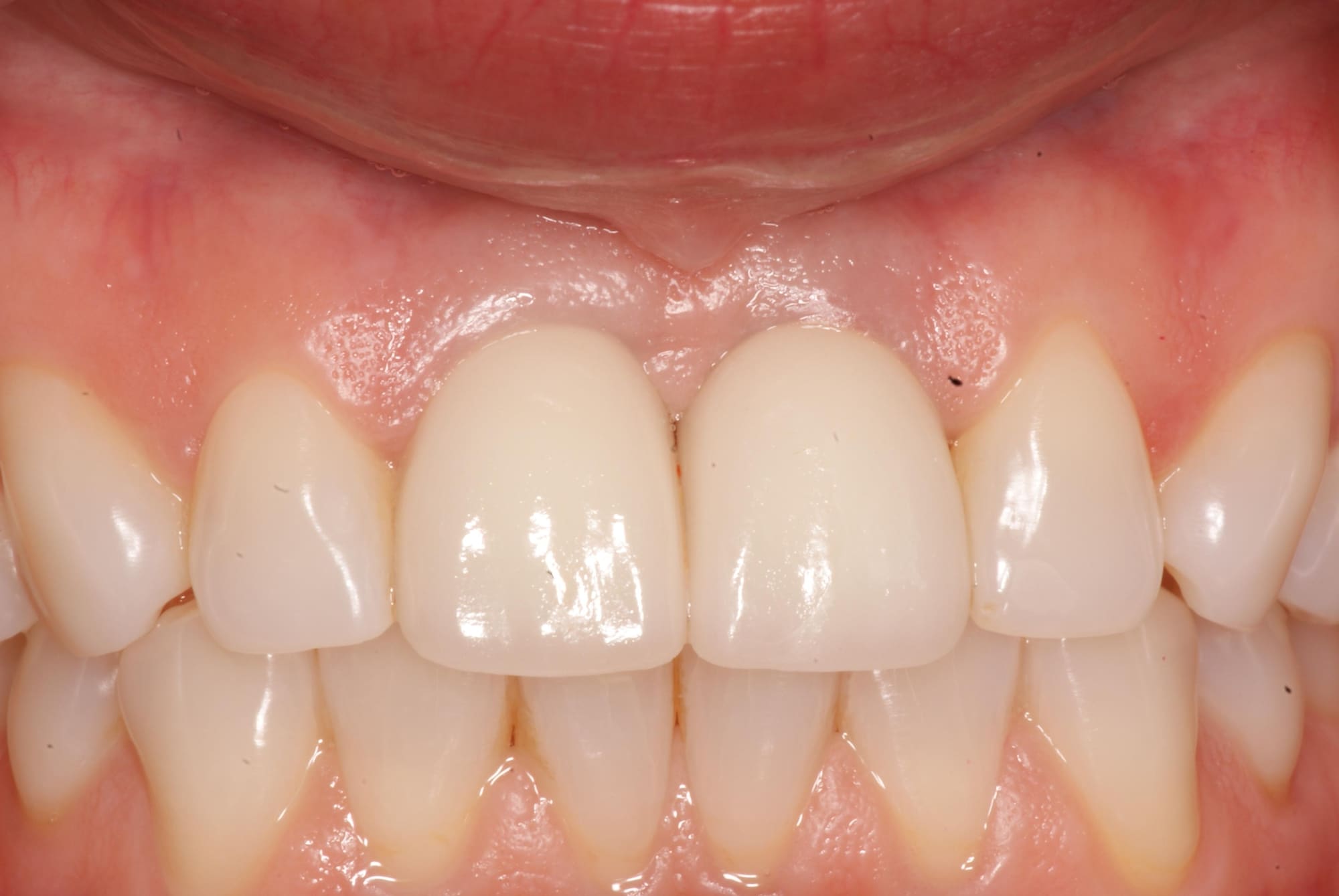 Photo Gallery Sherman Oaks Dental Group