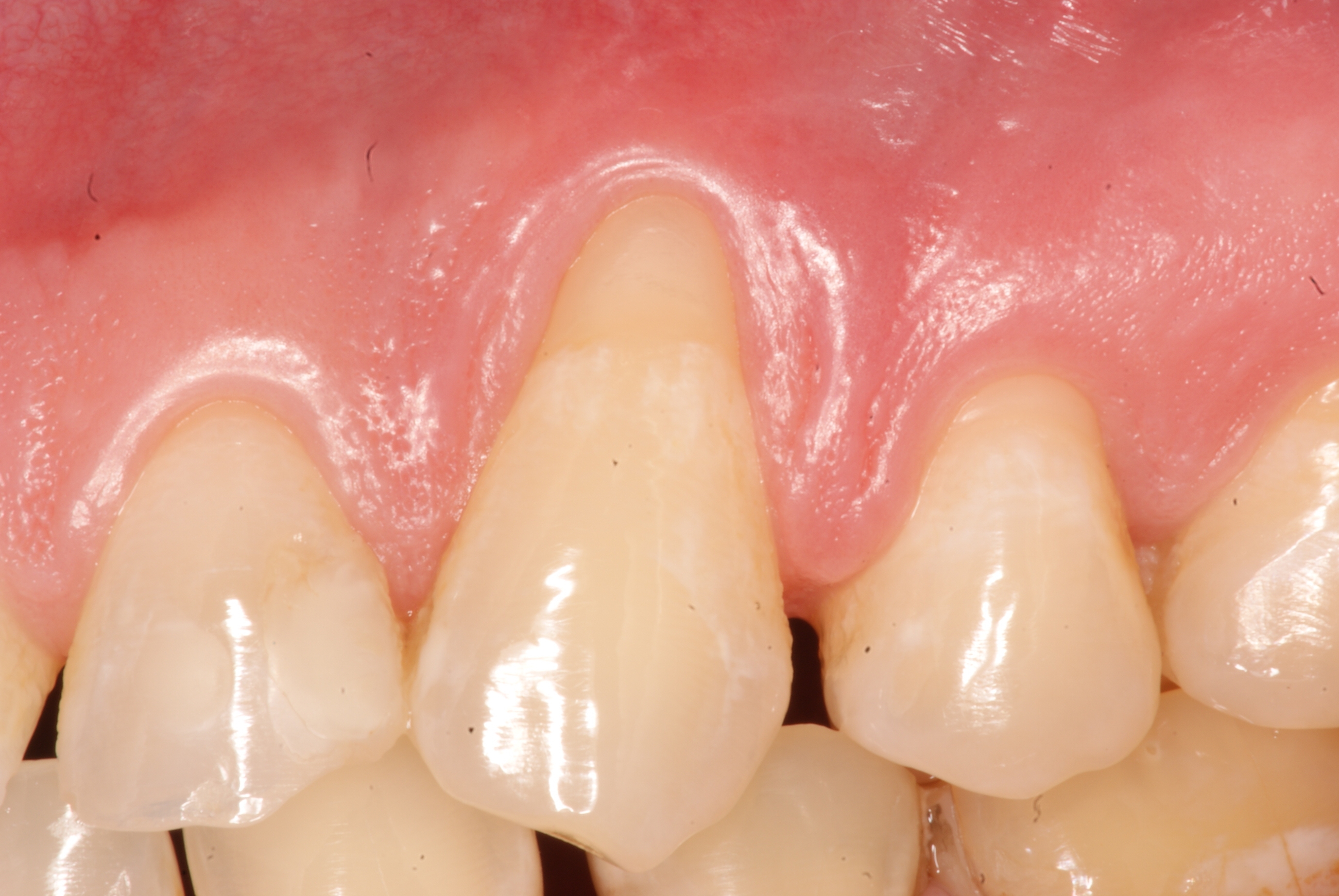 Photo Gallery Sherman Oaks Dental Group