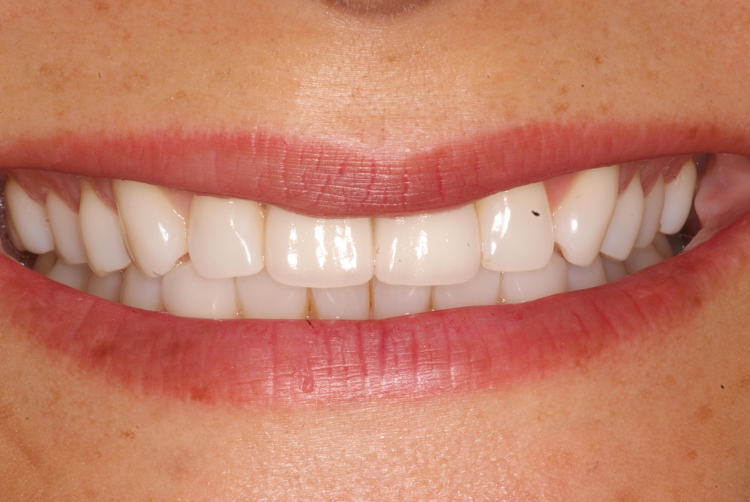 Photo Gallery Sherman Oaks Dental Group