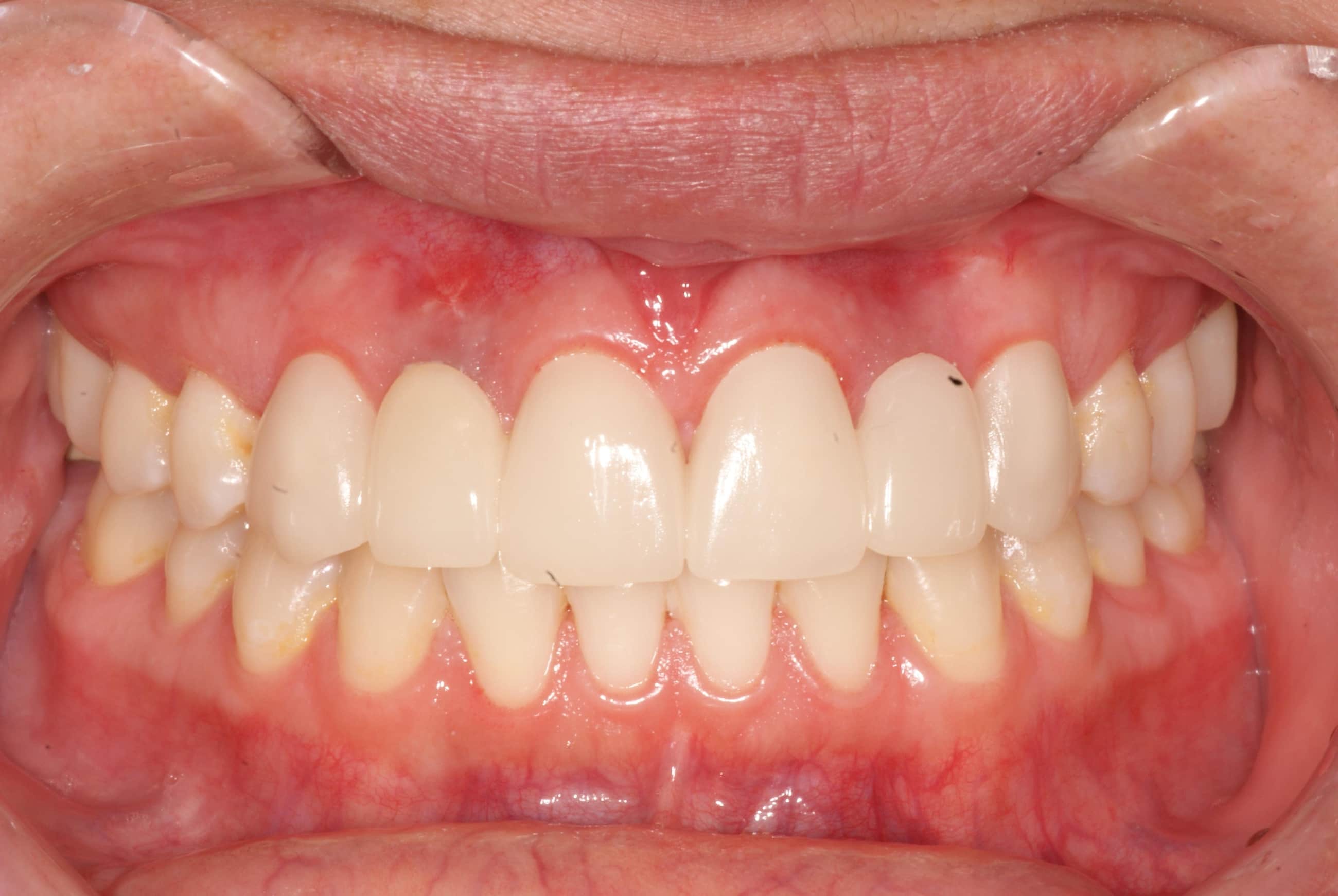 Photo Gallery Sherman Oaks Dental Group