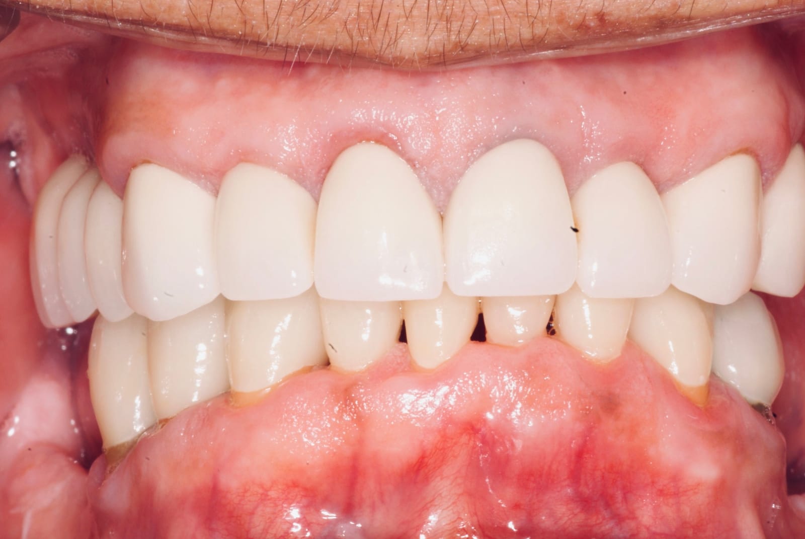 Photo Gallery Sherman Oaks Dental Group