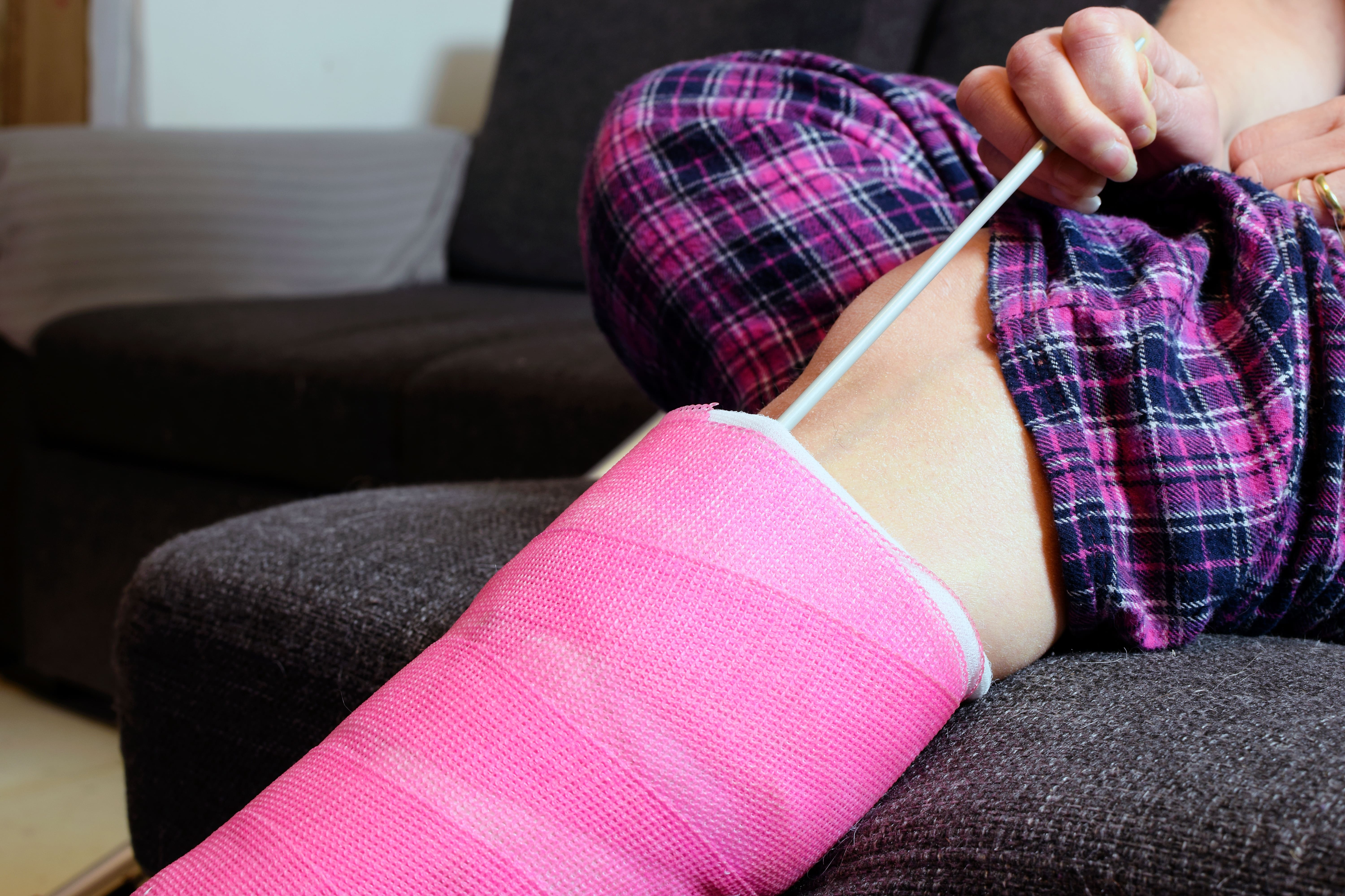 The Truth About Fiberglass Casts for Bone Fractures