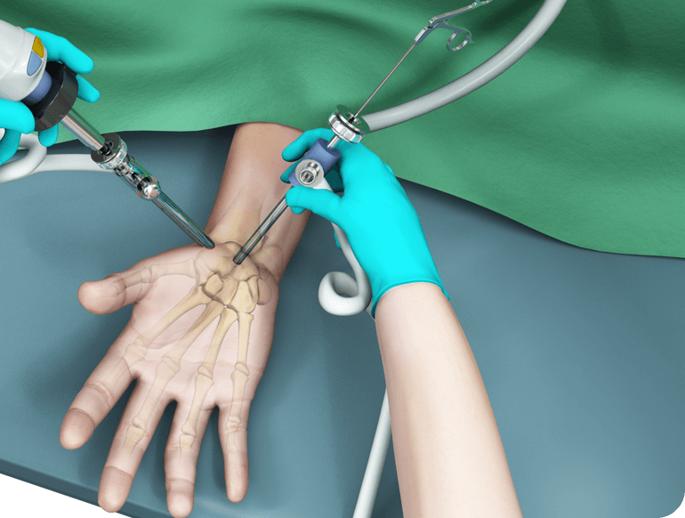 KU Plastic Surgery Hand Specialist Kansas City Plastic Surgery