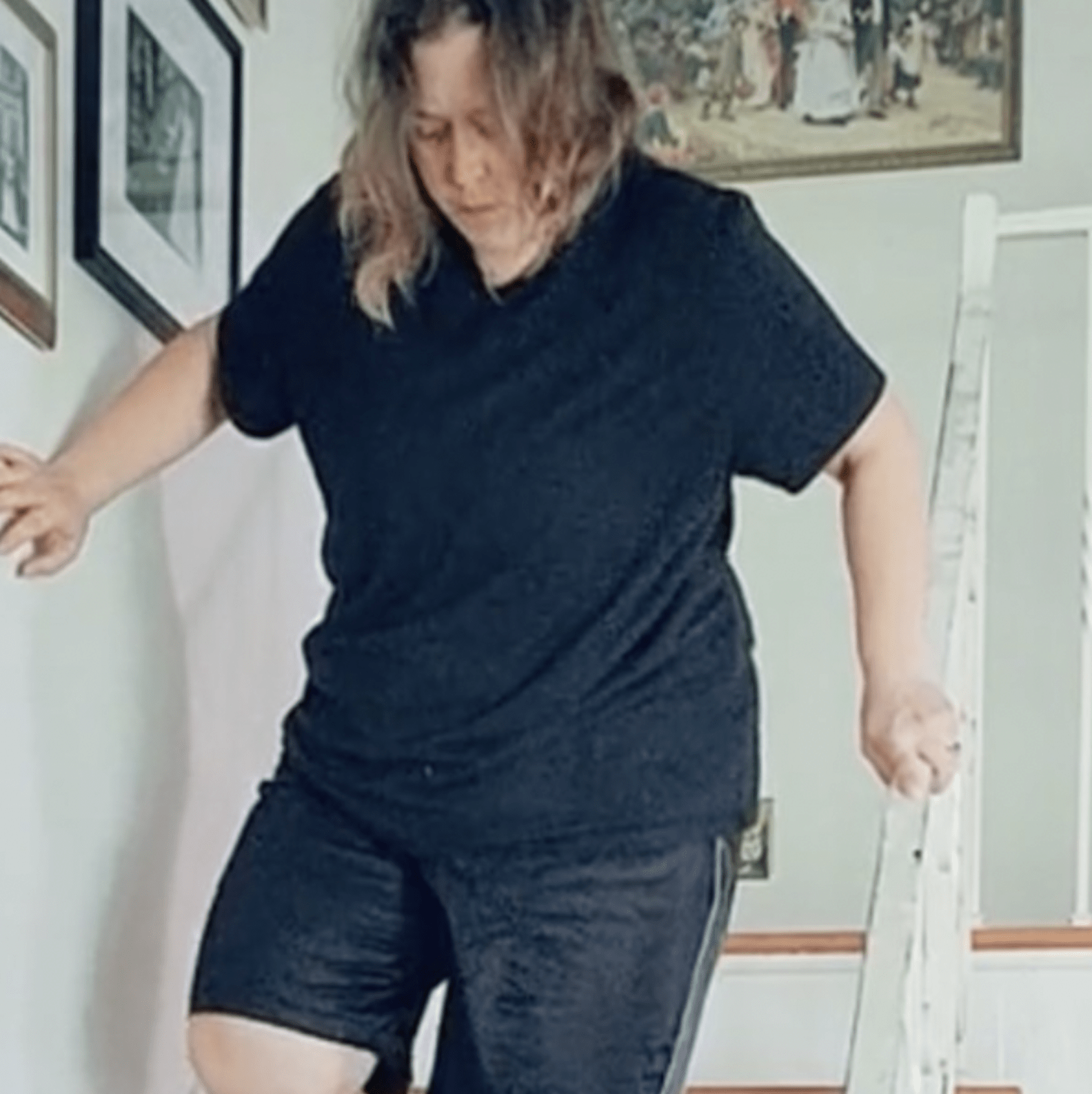 Rico The Rescue Dog Insists On Limping Down Stairs After Mom Breaks Her