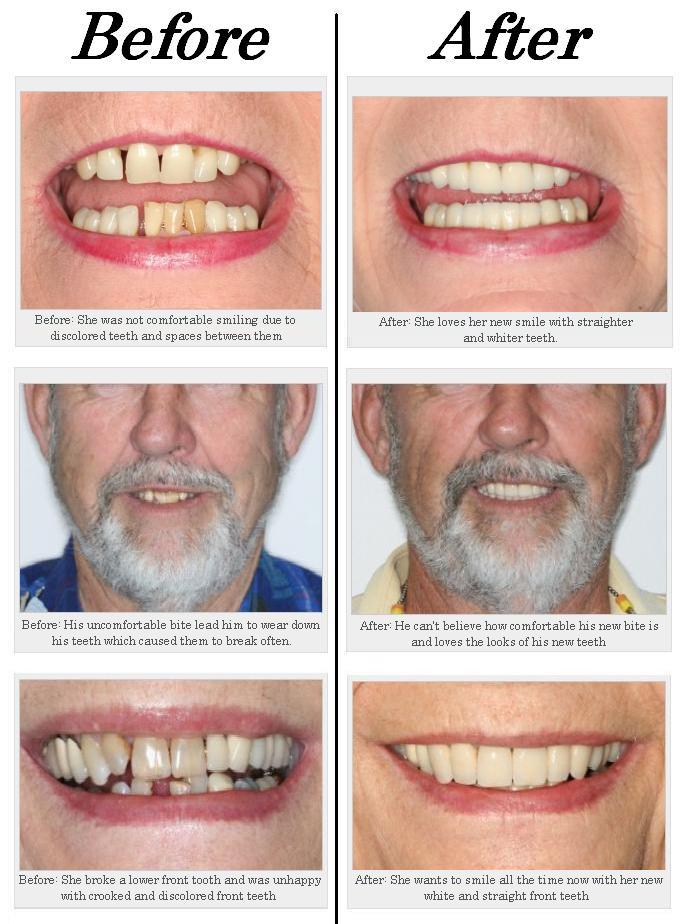 Discuss on Cosmetic Dentist fort Lauderdale Assignment Point