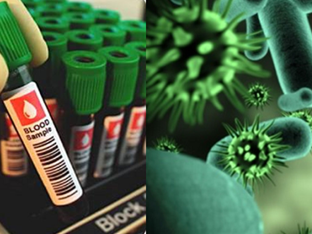 IATA Infectious Substances Shipping Guidelines Course IATA Courses