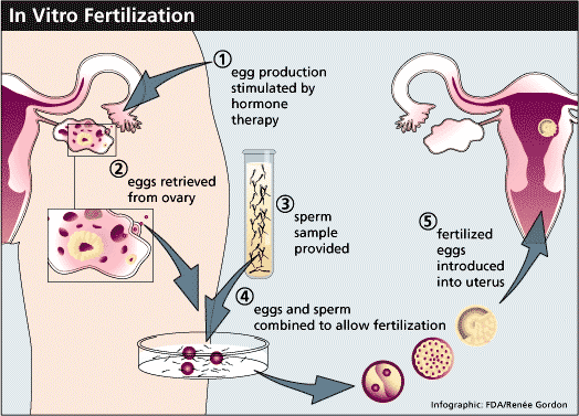 Do Test Tube Babies Have Souls? Atheology