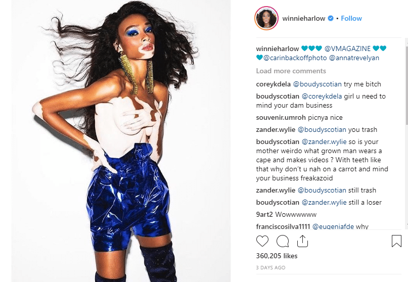 Winnie Harlow Has Divine Comeback for Snarky Comment About Her Vitiligo