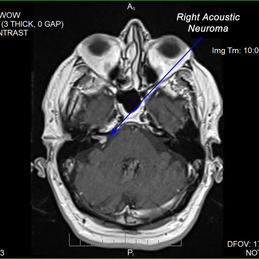 Audiology & Hearing Aids Atlantic ENT LLCAtlantic ENT LLC
