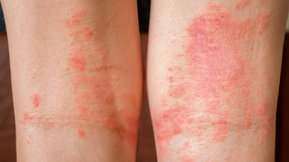 Is Acidic Water Bad For You? Atlas Scientific