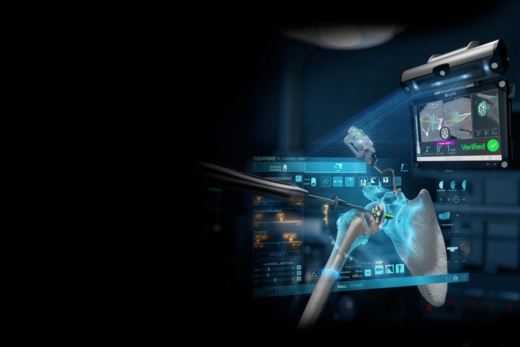 GPS Shoulder and Equinoxe Planning App Exactech