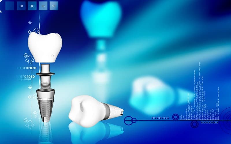 5 Ways Advances in Dental Technology Can Benefit You Aurora Dentist