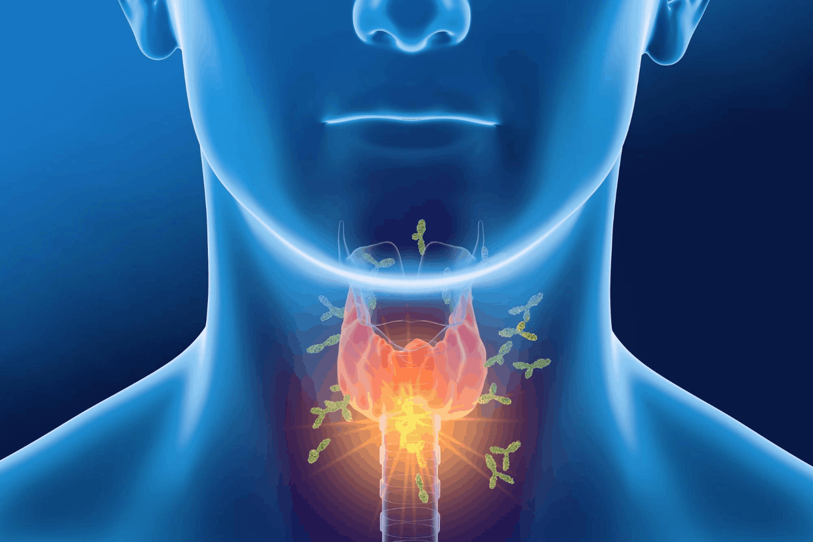 9 Functional Remedies To Get Thyroid Antibodies in Control