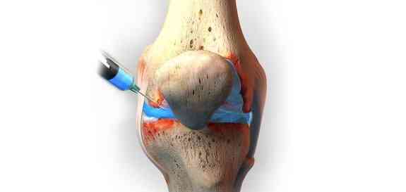Knee Injections in Austin Austin Preferred Integrative Medicine