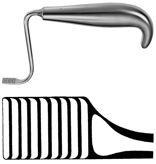 AEDO418R, TESSIER RETRACTOR MAXILLARY MOBILIZER LEFT 150 mm, 6″ AUSTOS