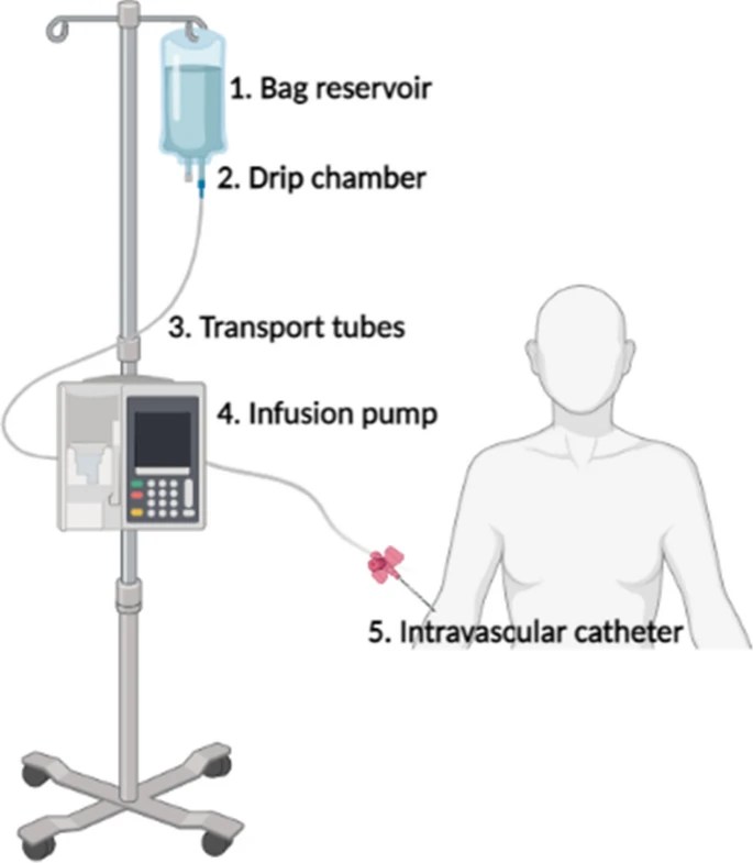 What is an Infusion Pump Used for Functionality, Applications, and