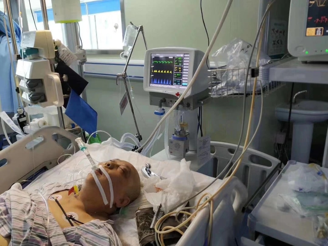 ICU VENTILATOR (ADULT PEDIATRIC) Automens Systems