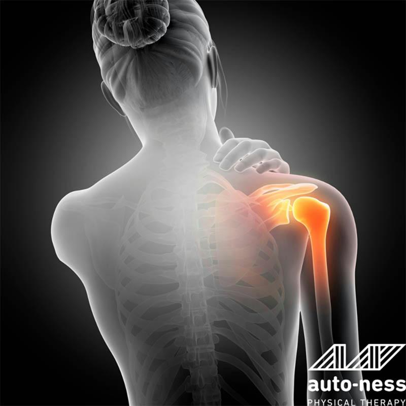 Shoulder Pain Expert Guidance from Impingement to Recovery