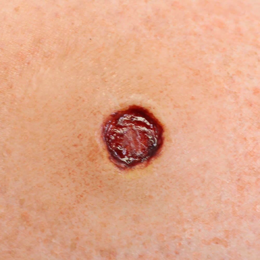 Bullet Wound 2 Autonomous F/X