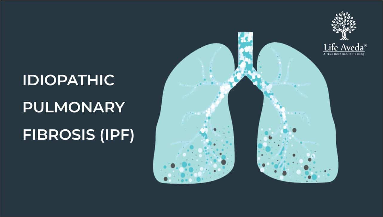 Idiopathic Pulmonary Fibrosis Causes, Diagnosis Ayurvedic Treatment