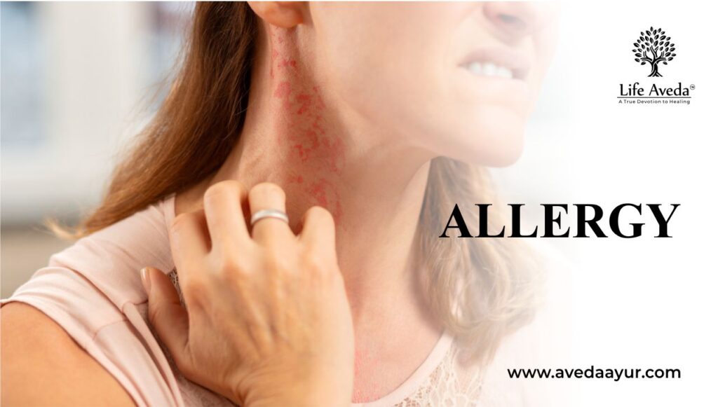 Allergy Causes, Symptoms, and Ayurvedic Treatment