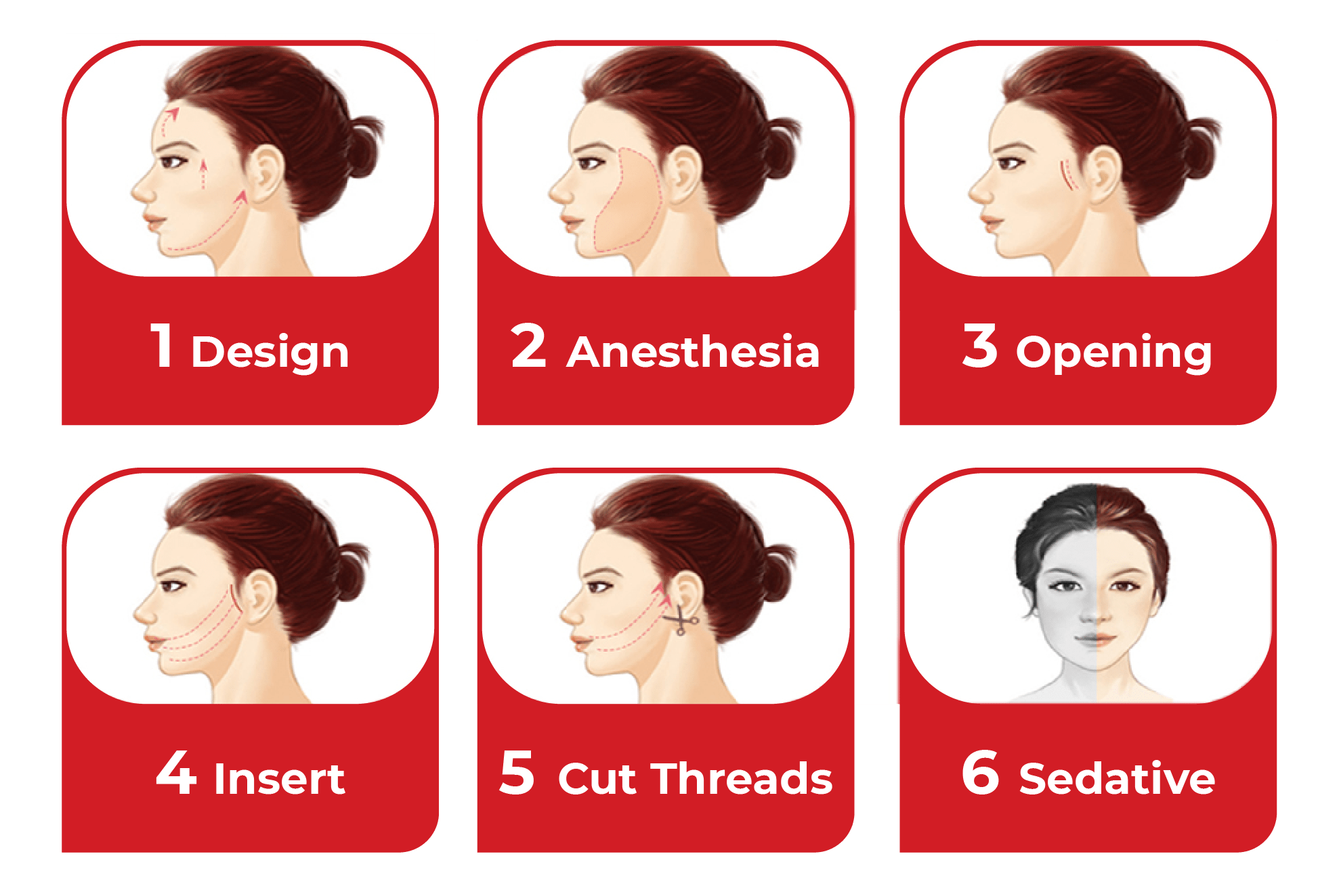 Lifting Threads AVENTA
