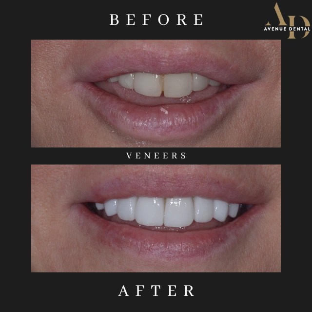 Dentist Leamington Spa 5* Rated Dental Practice Leamington