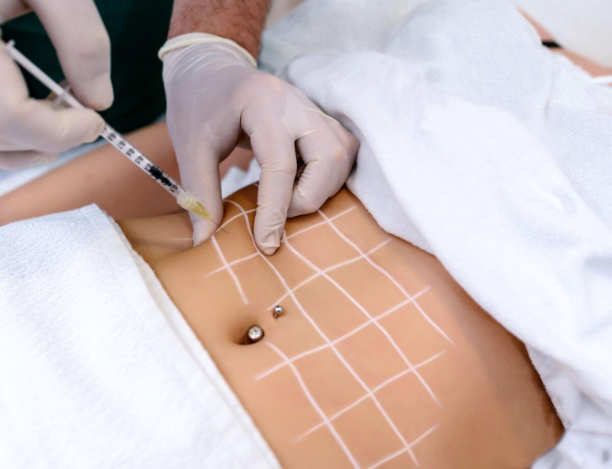 7 MindBlowing Secrets of Lipolytics You Must Know Now