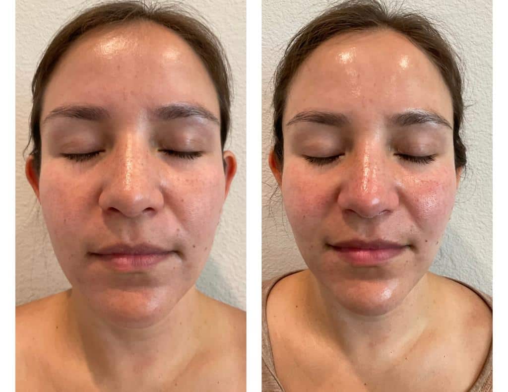 Hydrafacial landing page Avia Medical Spa